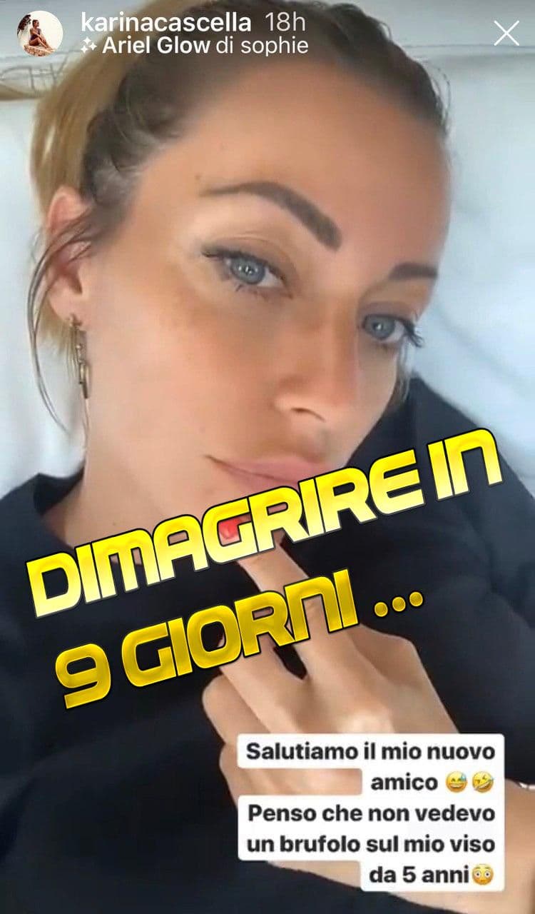Karina Cascella scivola gravemente. Instagram “Promozione dimagrante”